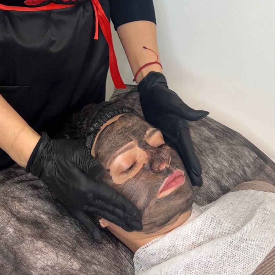 КАРБОНОВЫЙ ПИЛИНГ