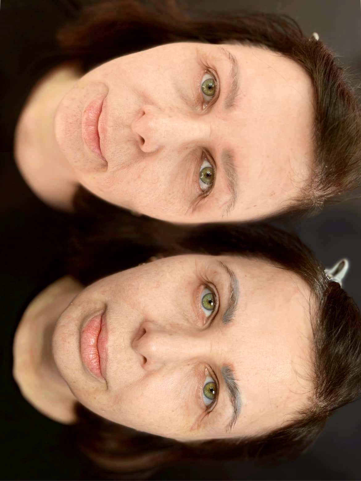 ОСВЕТЛЕНИЕ ТАТУАЖА и ТАТУИРОВОК